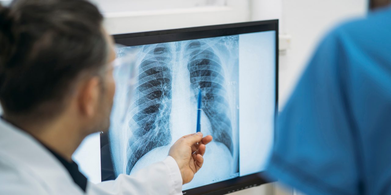 不同类型肺小结节：应区别对待