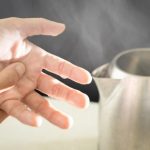 烧烫伤急救，你做对了吗？