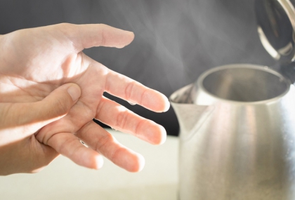 烧烫伤急救，你做对了吗？