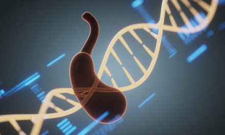 积极治疗，提升胰腺癌长期生存