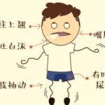 患了 “类风关”  且看中医巧调治